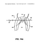 Devices and Methods for Heart Valve Treatment diagram and image