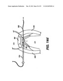 Devices and Methods for Heart Valve Treatment diagram and image