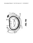 Devices and Methods for Heart Valve Treatment diagram and image