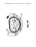 Devices and Methods for Heart Valve Treatment diagram and image