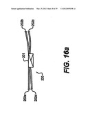 Devices and Methods for Heart Valve Treatment diagram and image