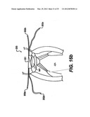 Devices and Methods for Heart Valve Treatment diagram and image