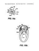 Devices and Methods for Heart Valve Treatment diagram and image