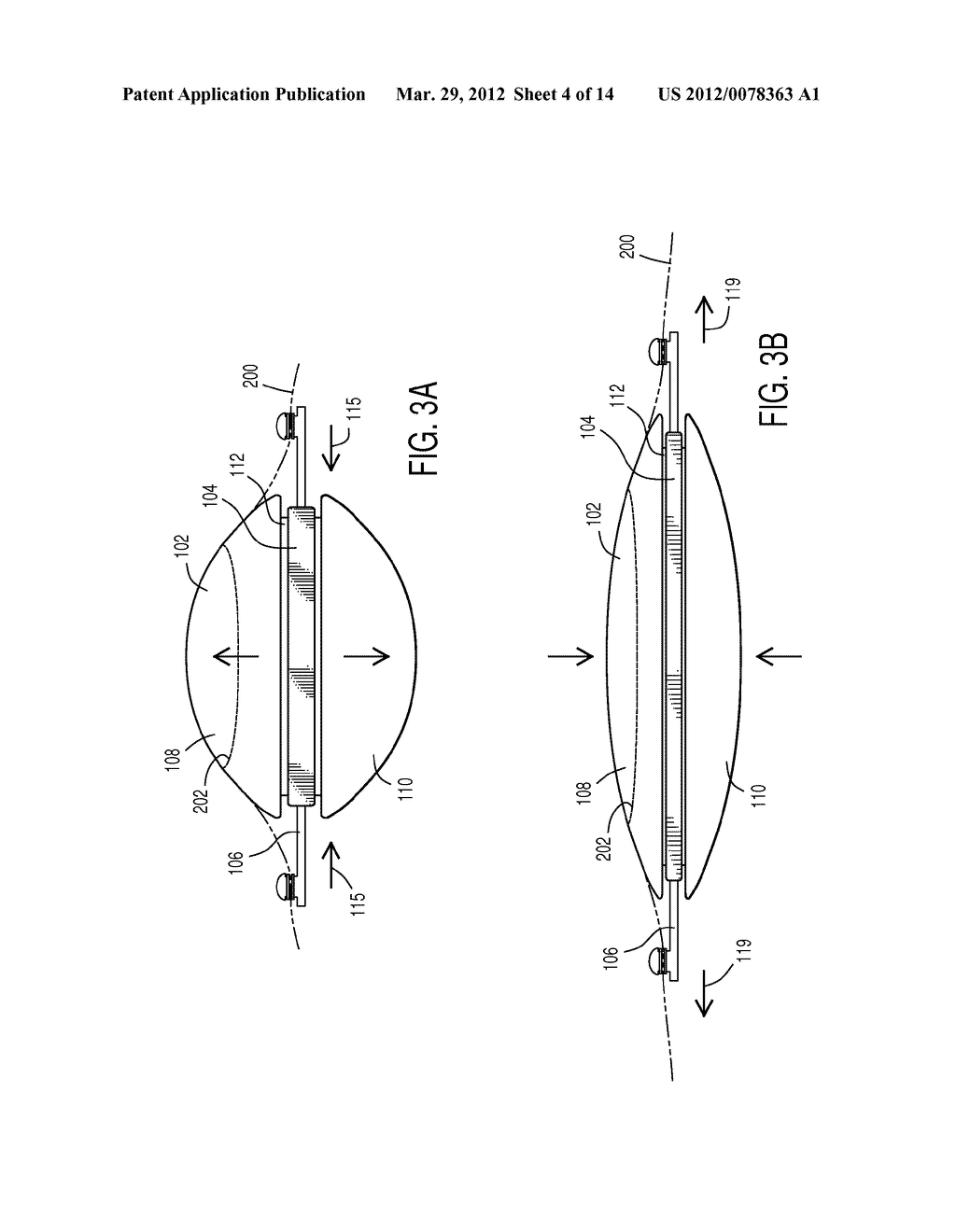 ACCOMMODATING INTRAOCULAR LENS - diagram, schematic, and image 05