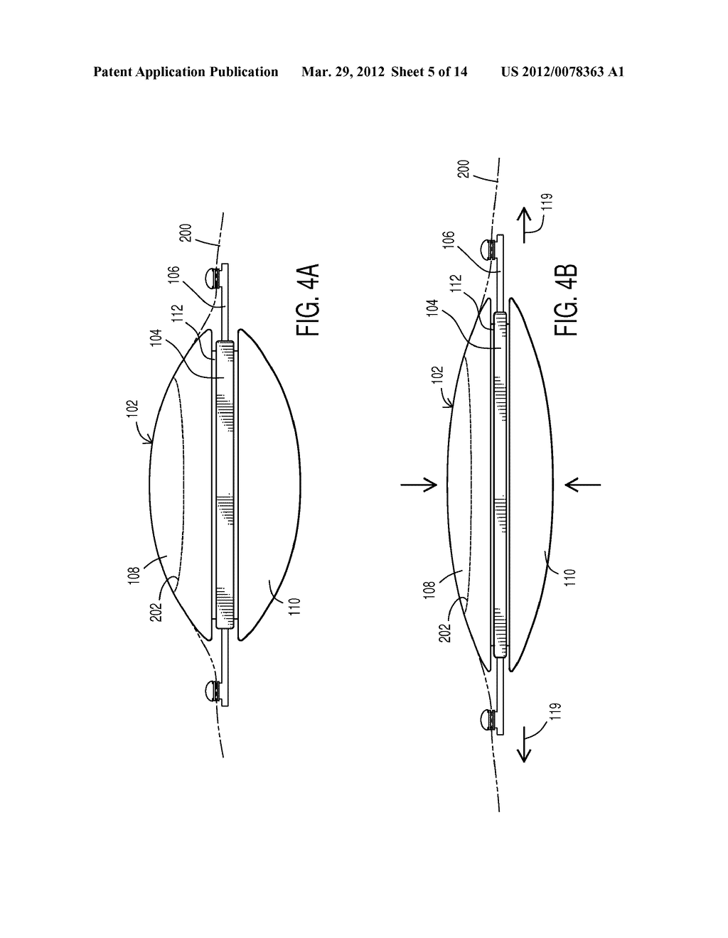 ACCOMMODATING INTRAOCULAR LENS - diagram, schematic, and image 06