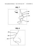 COLUMELLAR STRUT FOR NASAL TIP SUPPORT diagram and image