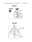 COLUMELLAR STRUT FOR NASAL TIP SUPPORT diagram and image