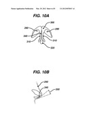 COLUMELLAR STRUT FOR NASAL TIP SUPPORT diagram and image