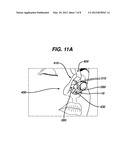 COLUMELLAR STRUT FOR NASAL TIP SUPPORT diagram and image