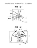 COLUMELLAR STRUT FOR NASAL TIP SUPPORT diagram and image