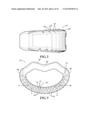 SPINAL IMPLANTS diagram and image