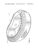 SPINAL IMPLANTS diagram and image