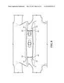 SPINAL IMPLANTS diagram and image