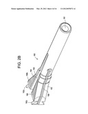 NOVEL IMPLANT INSERTER HAVING A LATERALLY-EXTENDING DOVETAIL ENGAGEMENT     FEATURE diagram and image