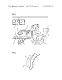 METHOD FOR PREDICTING ANEURYSM GROWTH diagram and image