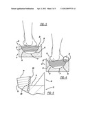 MEASUREMENT SYSTEM FOR VARUS/VALGUS ANGLES IN FEET diagram and image