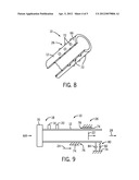 PULSE DETONATION TUBE WITH LOCAL FLEXURAL WAVE MODIFYING FEATURE diagram and image