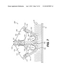 MACHINE AND METHOD FOR HAIR OR BRISTLE REMOVAL diagram and image