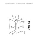 MACHINE AND METHOD FOR HAIR OR BRISTLE REMOVAL diagram and image