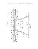 EXPANDABLE TABLE diagram and image