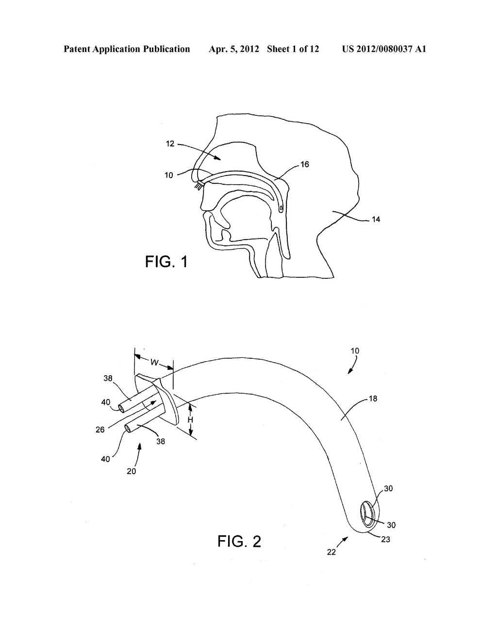 NASOPHARYNGEAL AIRWAY - diagram, schematic, and image 02