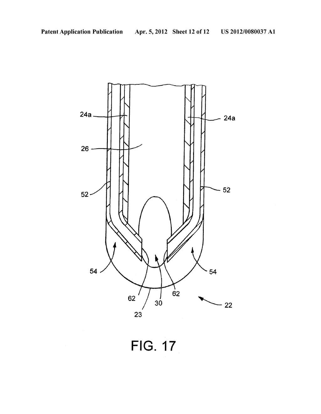 NASOPHARYNGEAL AIRWAY - diagram, schematic, and image 13