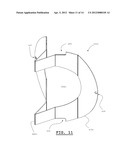 VANE INLET DEVICE diagram and image