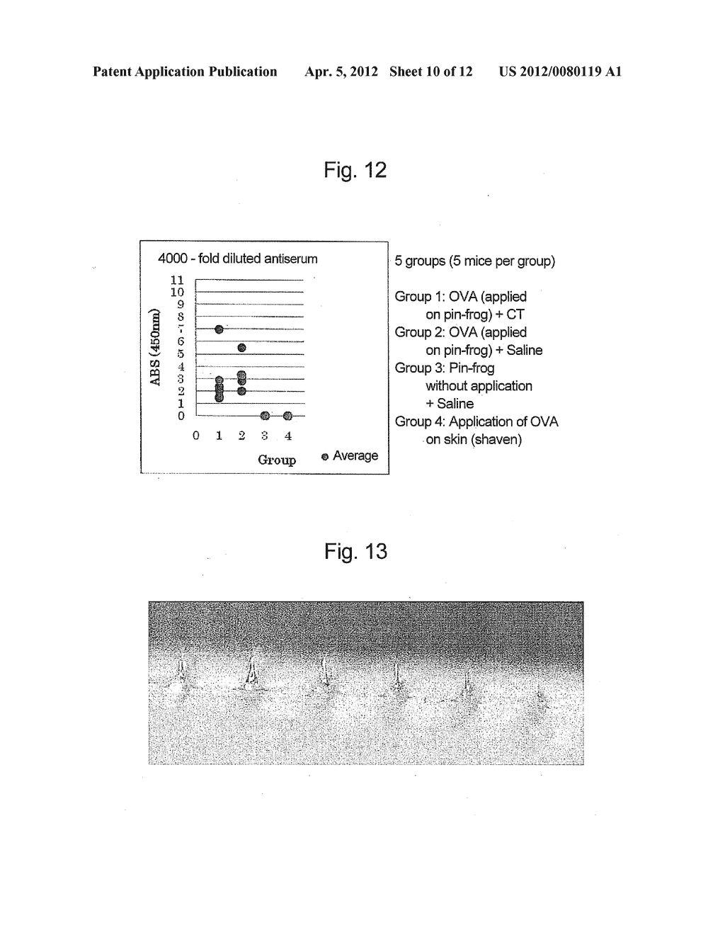 MEDICATION LIQUID SUPPORTING JIG AND METHOD OF APPLYING MEDICATION TO     MICRO-NEEDLE USING SAME - diagram, schematic, and image 11