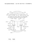 TISSUE THICKNESS COMPENSATOR FOR A SURGICAL STAPLER diagram and image