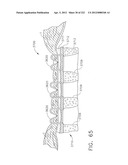 STAPLE CARTRIDGE COMPRISING A VARIABLE THICKNESS COMPRESSIBLE PORTION diagram and image