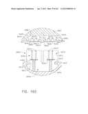 STAPLE CARTRIDGE COMPRISING A VARIABLE THICKNESS COMPRESSIBLE PORTION diagram and image