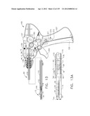 IMPLANTABLE FASTENER CARTRIDGE COMPRISING A SUPPORT RETAINER diagram and image