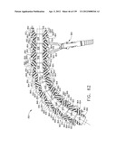 IMPLANTABLE FASTENER CARTRIDGE COMPRISING A SUPPORT RETAINER diagram and image