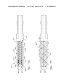 IMPLANTABLE FASTENER CARTRIDGE COMPRISING A SUPPORT RETAINER diagram and image