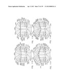 IMPLANTABLE FASTENER CARTRIDGE COMPRISING A SUPPORT RETAINER diagram and image