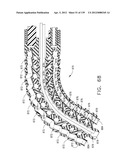 IMPLANTABLE FASTENER CARTRIDGE COMPRISING BIOABSORBABLE LAYERS diagram and image