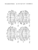 IMPLANTABLE FASTENER CARTRIDGE COMPRISING BIOABSORBABLE LAYERS diagram and image