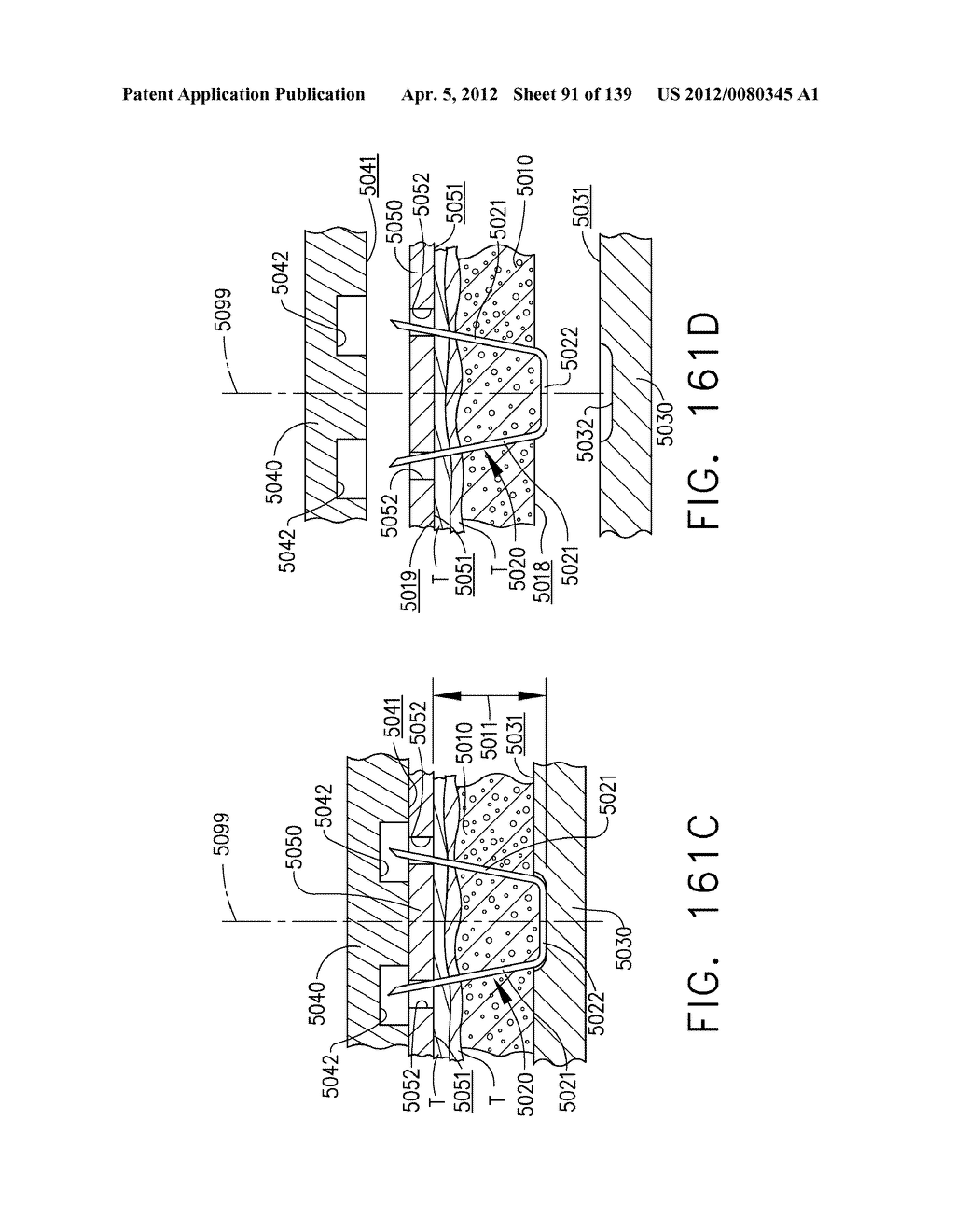 IMPLANTABLE FASTENER CARTRIDGE COMPRISING BIOABSORBABLE LAYERS - diagram, schematic, and image 92