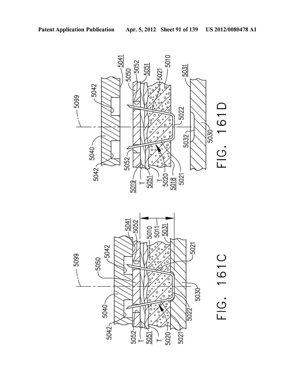 SURGICAL STAPLE CARTRIDGES WITH DETACHABLE SUPPORT STRUCTURES AND SURGICAL     STAPLING INSTRUMENTS WITH SYSTEMS FOR PREVENTING ACTUATION MOTIONS WHEN A     CARTRIDGE IS NOT PRESENT - diagram, schematic, and image 92