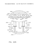 IMPLANTABLE FASTENER CARTRIDGE COMPRISING MULTIPLE LAYERS diagram and image