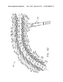 IMPLANTABLE FASTENER CARTRIDGE COMPRISING MULTIPLE LAYERS diagram and image