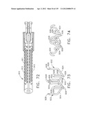 IMPLANTABLE FASTENER CARTRIDGE COMPRISING MULTIPLE LAYERS diagram and image