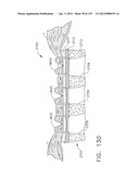 IMPLANTABLE FASTENER CARTRIDGE COMPRISING MULTIPLE LAYERS diagram and image