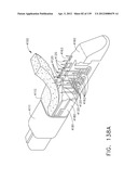 IMPLANTABLE FASTENER CARTRIDGE COMPRISING MULTIPLE LAYERS diagram and image