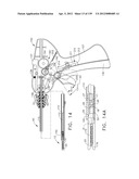 FASTENING INSTRUMENT FOR DEPLOYING A FASTENER SYSTEM COMPRISING A     RETENTION MATRIX diagram and image