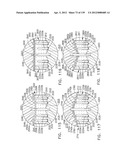 FASTENING INSTRUMENT FOR DEPLOYING A FASTENER SYSTEM COMPRISING A     RETENTION MATRIX diagram and image