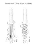 SURGICAL STAPLER ANVIL COMPRISING A PLURALITY OF FORMING POCKETS diagram and image