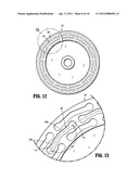 Surgical Stapling Device For Performing Circular Anastomosis And Surgical     Staples For Use Therewith diagram and image