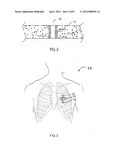 Method for Surgical Stapling diagram and image