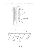 Method for Surgical Stapling diagram and image